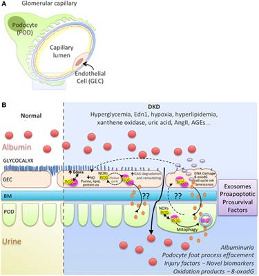 Glomerular Endothelial Cell Stress and Cross-Talk With Podocytes in Early Diabetic Kidney Disease